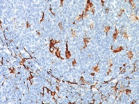 Tonsil stained with CD163 antibody