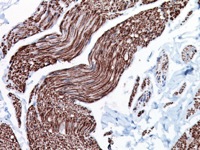 Bladder muscle stained with Smoothelin antibody