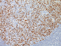 Tonsil stained with Bcl-6 antibody