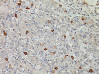 Pituitary gland stained with Follicle Stimulating Hormone (FSH) antibody