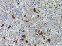 Pituitary gland stained with Thyroid Stimulating Hormone (TSH) antibody