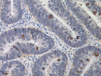 Colon stained with IGF-1R antibody
