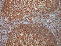 Tonsil stained with Oct-2 antibody