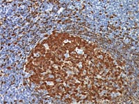 Tonsil stained with BOB-1 antibody