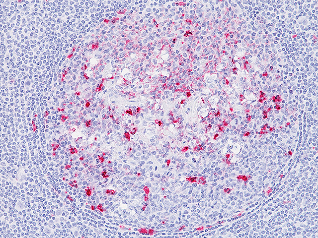 Sheep Spleen stained with Prion IHC Assay