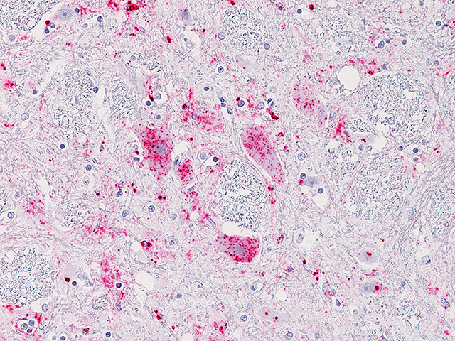 Sheep Brain stained with Prion IHC Assay