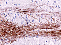 Mouse-on-Rat: Mouse Neurofilament on rat brain