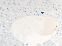 Mouse liver with Rodent Block and XR Factor