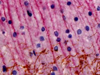 Rat and Mouse Double Stain Polymer: Mouse Neurofilament and rabbit GFAP on rat brain