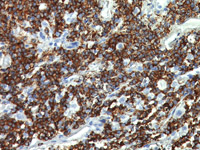 Kappa Light Chain DNA Probe - Staining bone marrow plasma cell myeloma