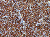 Lambda Light Chain DNA Probe - Staining bone marrow myeloma of the neck