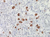 Cytomegalovirus (CMV) Probe - Staining CMV infected lung cells
