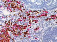 Dual Kappa / Lambda RISH Probe - Staining polyclonal plasma cells