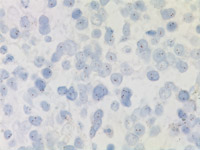 (Negative) non-amplified HER2/neu at 40x