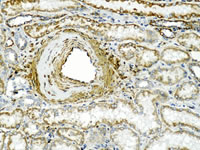 Endogenous biotin background is detected in tissue around the artery
