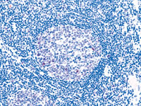 Competitor: Dextran backbone polymer, 1:200 dilution