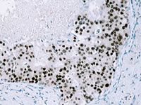Leading competitor using dextran backbone polymer, 1:25 dilution