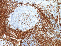 Tonsil stained with CD3 using ABC detection system