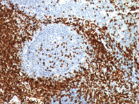 Tonsil stained with CD3 using MACH 1 detection