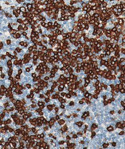 Tonsil stained with CD20 antibody