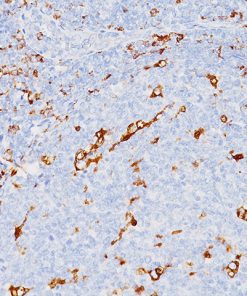 Tonsil stained with CD68 antibody.