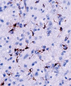 Rat cerebellum stained with Glial Fibrillary Acidic Protein Antibody