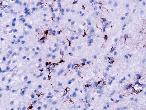 Rat cerebellum stained with Glial Fibrillary Acidic Protein Antibody
