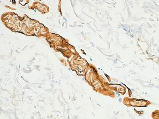 Skin stained with Collagen IV antibody