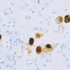 CMV infected tissue stained with Cytomegalovirus antibody