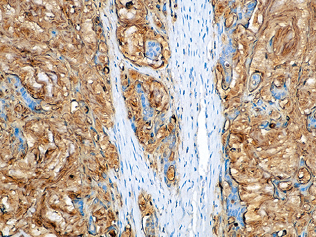 CA 19-9 Antibody - Biocare Medical