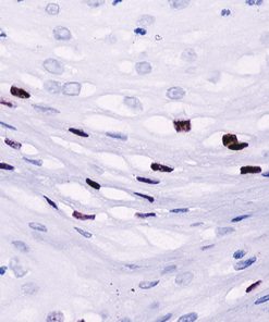 Cervix stained with HPV-16 antibody.