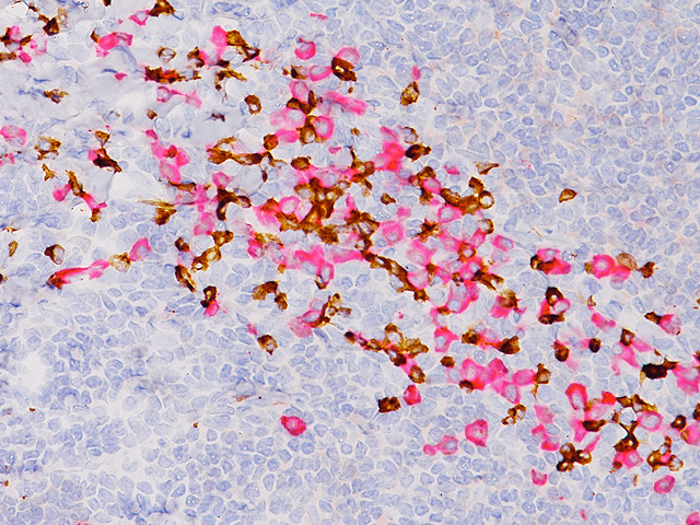 Tonsil stained with Kappa + Lambda