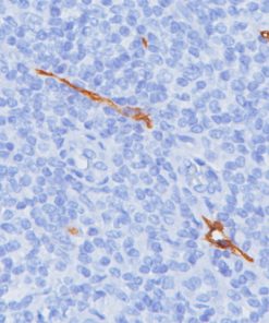 Lymphatic vessel stained with D2-40 antibody (Lymphatic Marker)