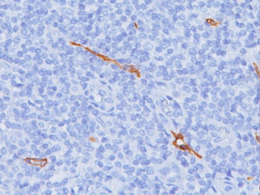 Lymphatic vessel stained with D2-40 antibody (Lymphatic Marker)