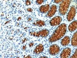 Stomach stained with Mucin 5AC antibody