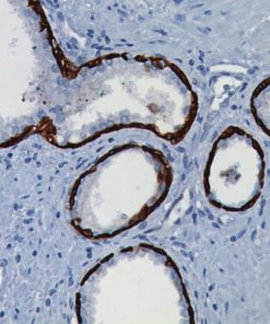 Prostate stained with Cytokeratin 5