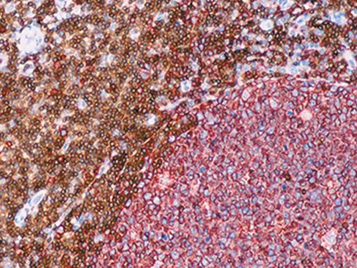 Tonsil stained with L26 + CD3