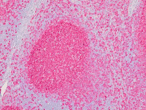 intelliPATH FLX Fast Red Chromogen Kit - Biocare Medical