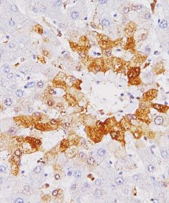 Liver stained with Glutamine Synthetase antibody