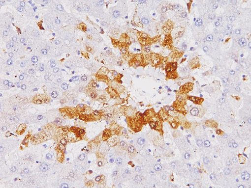 Liver stained with Glutamine Synthetase antibody