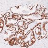 Prostate stained with Cytokeratin 5/14 antibody