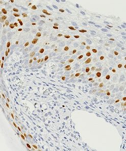 Normal cervix stained with Topoisomerase II alpha antibody