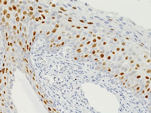 Normal cervix stained with Topoisomerase II alpha antibody