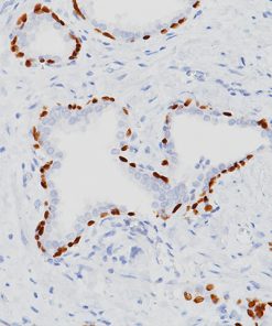 Prostate stained with p40 (M) Antibody, 3X