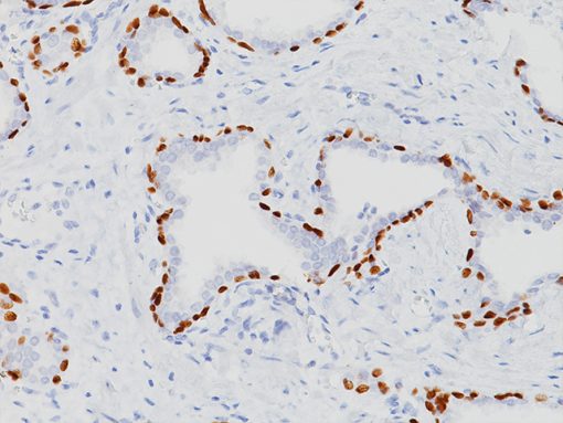 Prostate stained with p40 (M) Antibody, 3X