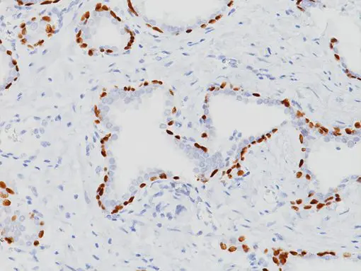 Prostate stained with p40 (M) Antibody, 3X