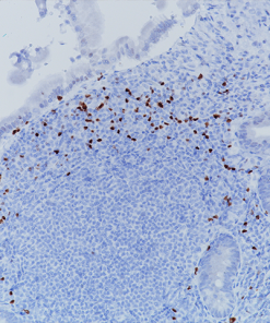 Peyer's patches stained with ROR gamma T