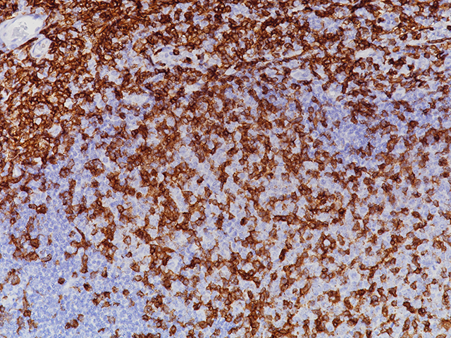 CD4 RM Biocare Medical