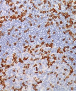 Tonsil stained with CD3 antibody