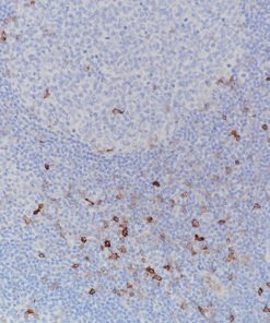 Tonsil stained with OX40/CD134 antibody